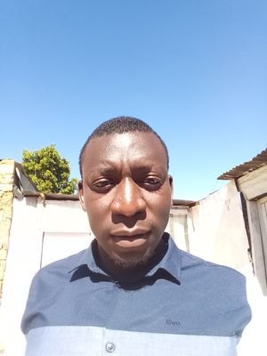 my skin colour ugliness bold man my tride