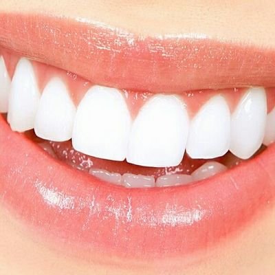 Professional Teeth Technicians Offering, Cleaning, whitening and strengthening.