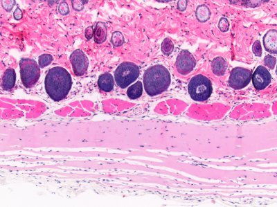 To do item 1352: remember to format your Twitter bio 
Item 1460 done: those are some fine-looking bone metastatic cells in that xenograft.