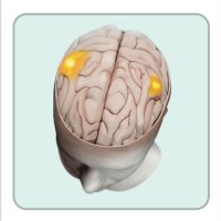 Dysphagia (@dysphagiatalk) 's Twitter Profile Photo