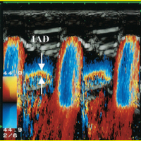 International Journal of Cardiovascular Imaging (@intjcvimaging) 's Twitter Profile Photo International Journal of Cardiovascular Imaging (@intjcvimaging) 's Twitter Profile Photo