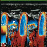 International Journal of Cardiovascular Imaging(@IntJCVImaging) 's Twitter Profileg