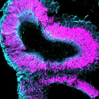 Lab at FAU Erlangen-Nürnberg interested in human neuron formation