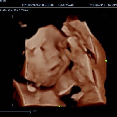 Wani Syazwani (@qasehnurlaila) / Twitter