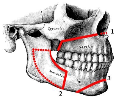 Trying to raise money for life changing jaw correction surgery

https://t.co/bHT1wALXvc