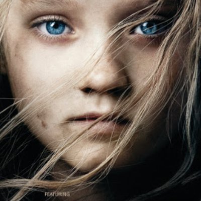 ONLY4UEYES1's profile picture. Hopeful news  for people with retinal dystrophies and other pathologies that affect vision.