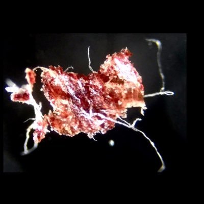 Gadolinium_MRI's profile picture. Gadolinium Contrast Victim