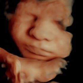 3D - 4D Baby Scanning Studio