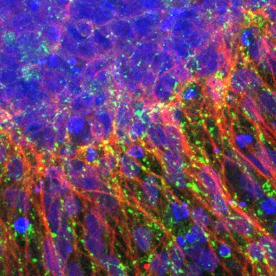 Neuroscience lab investigating the molecular mechanisms of memory and how these mechanisms are disrupted in a variety of cognitive disorders.