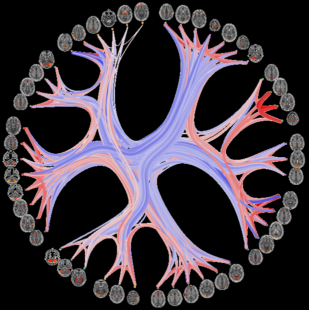 The Personomics Research Group, headed by Janine Bijsterbosch, is interested in personalized connectomics and its potential as a biomarker for mental health