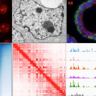 We study #epigenetics, #chromatin, #3Dgenome organization and the role of #nucleolus in stem cells and cancer
