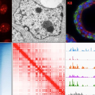 We study #epigenetics, #chromatin, #3Dgenome organization and the role of #nucleolus in stem cells and cancer