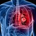 Glenfield Thoracic Surgery (@surgerythoracic) Twitter profile photo Glenfield Thoracic Surgery (@surgerythoracic) Twitter profile photo