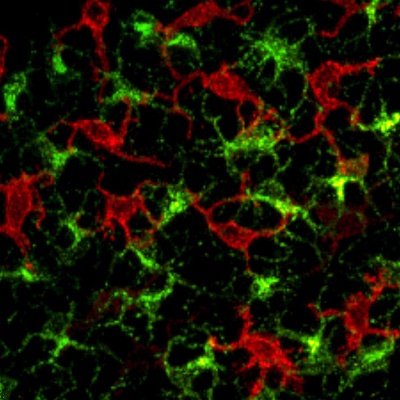 Immunologist, group leader at Imperial College London, UK.
We study how tissue resident immune cells regulate epithelial cell homeostasis, repair and cancer