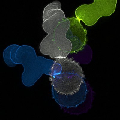 Our aim is to determine the molecular mechanisms by which tissue confinement controls cell behavior, particularly as it relates to the progression of cancer.