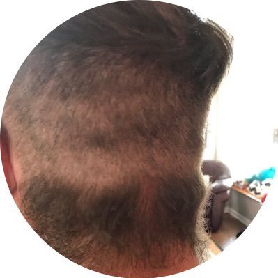 beardtrap's profile picture. One Winged Angler // Best Trout Machine // The Cod Among Insects