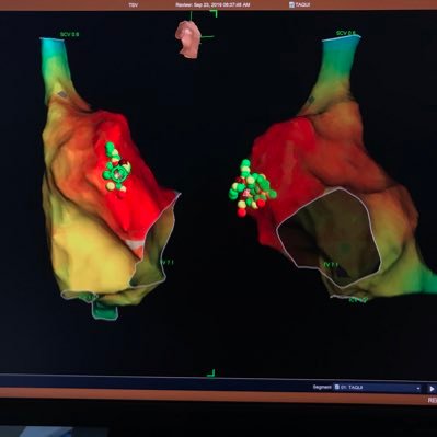 EdgarHe72910873's profile picture. Abbott Field Clinical Specialist II