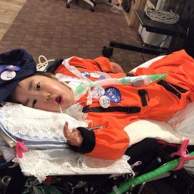 気管切開 人工呼吸器・ストレッチャーの娘 ゆりニャーは 先天性ミオパチー という筋肉の難病です。ベッドの上にいてもワクワクしながら過ごしていきたいな