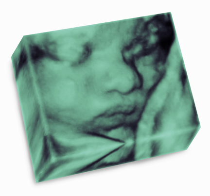 http://t.co/rLQ1o4TidO introduces the unique way to save and show your sonogram images as a precious piece of art.