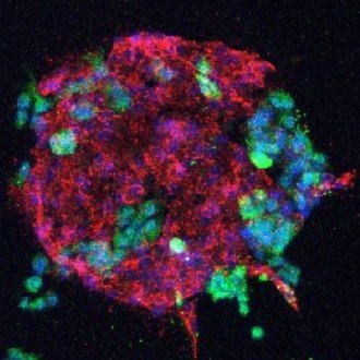 PiviOjala4's profile picture. Cancer cell biology and oncogenic viruses