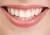 There are many methods to whiten teeth: We have the best, SO SHOULD YOU! Healthy Teeth.