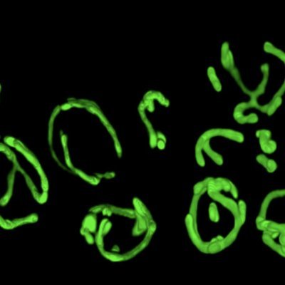 Research laboratory @DartmouthChem utilizing structural biology, biochemistry and cell biology to investigate the molecular mechanisms of selective autophagy.