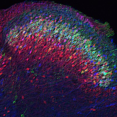 Basic Research & Therapeutics Laboratory focused on delineating neural circuits for Persistent Pain and Parkinson's Disease. @US_ASP @Pitt_brain @Painresforum