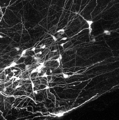 A federation of neuroscientists & physiologist @macquarie_uni, we study how circuits in the brain keep us alive and how their dysfunction causes disease