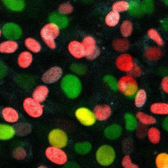 Melanocyte development and tissue homeostasis.