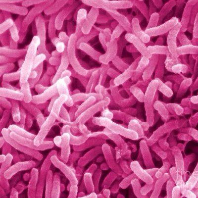 ArEmbarc's profile picture. Estudio Multicéntrico de las Bacteriemias por Bacilos Negativos Resistentes a Carbapenems de Argentina