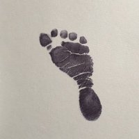 Jürgen Messner (@paedsorthopod) 's Twitter Profile