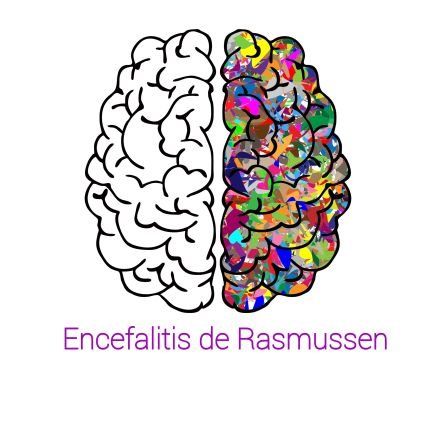 Grupo de familias conviviendo con la Encefalitis de Rasmussen. Buscando más casos en #España #encefalitisderasmussen #rasmussen #SindromeDeRasmussen