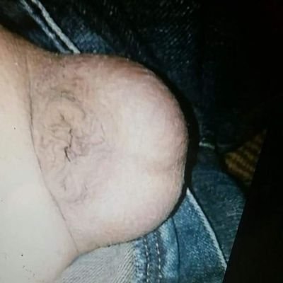 tiny little completely inverted micro penis