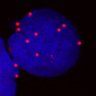 LabLachaud's profile picture. I am  deputy director at cancer research Center of Marseille, and group leader involved in DNA repair, genome instability and blood disorder