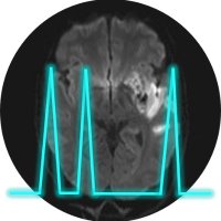 Neuro-AFib Coalition(@NeuroAFib) 's Twitter Profile Photo