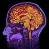 BSNNP1880's profile picture. Established 1880, it's the oldest organization for a meeting of the minds (and brains) in the western hemisphere, with the latest in clinical neuroscience!