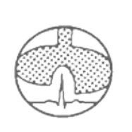 VVIZV_ Flemish Intensive Care Nursing (@vvizv1) 's Twitter Profile