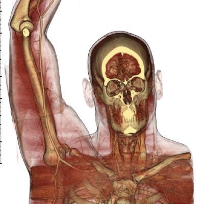 CV Imaging, 3D Radiology