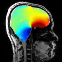Ali Aghaeifar (@aaghaeifar_mri) 's Twitter Profile