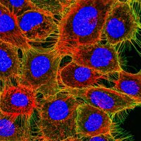 Simpson Team_Cancer Therapy (@simpsonteamuq) 's Twitter Profile