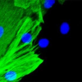 heartmusclecell's profile picture. New Technology News of Organoids and Stem Cell Therapy