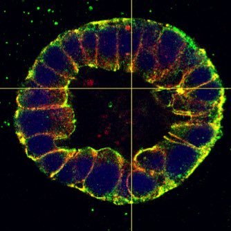 Where Cell-Cell adhesion meets RNAi - and other intriguing encounters. Molecular and Cellular Biology Lab at the Medical University of South Carolina