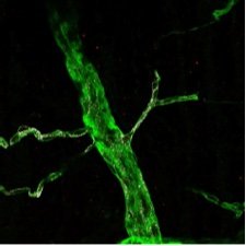 Grupo de Investigación en GENYO, Granada, liderado por Juan Carlos Rodríguez-Manzaneque. Apasionados por #tumormicroenvironment #ECMatrix #ADAMTSproteases