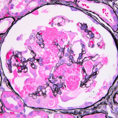 UWRenalPath's profile picture. Renal Pathology Group at the University of Washington. Tweets do not represent medical advice.