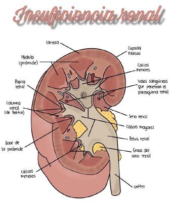 Somos un grupo de estudiantes de medicina de 3er semestre.
Queremos aprender sobre la insuficiencia renal y a través de este blog compartir nuestro aprendizaje.