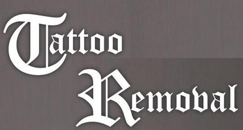 There are many reasons people might want a tattoo removal, and there are many methods for tattoo removal.