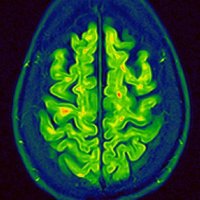 Neurologie_Mannheim(@Neuro_MA) 's Twitter Profile Photo