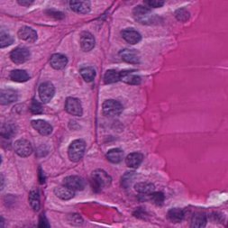 UK Endocrine Pathology Society
Networking for UK endocrine pathologists
Discussion of difficult cases
Expertise in endocrine pathology
CPD & clinical trials