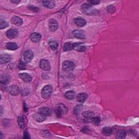 UK Endocrine Pathology Society (@ukepsoc) 's Twitter Profile
