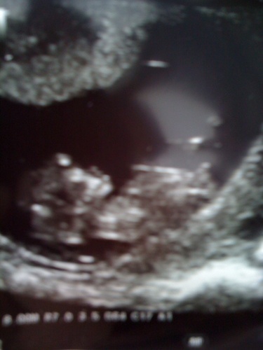 July2011baby's profile picture. 